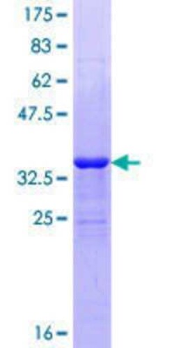 Novus Biologicals Recombinant Human VPS8 GST (N-Term) Protein 10 &mu;g | Buy Online | Novus Biologicals&trade; | Fisher Scientific