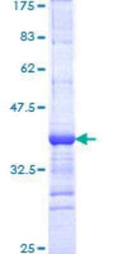 Novus Biologicals Recombinant Human VPS8 GST (N-Term) Protein 25 &mu;g | Buy Online | Novus Biologicals&trade; | Fisher Scientific