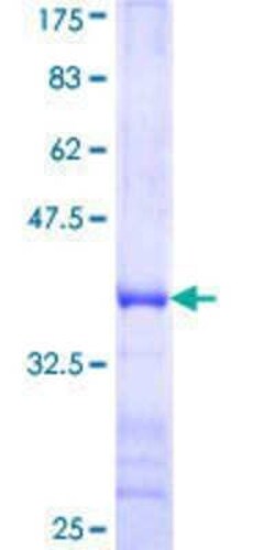 Novus Biologicals Recombinant Human LARG GST (N-Term) Protein 10 &mu;g | Buy Online | Novus Biologicals&trade; | Fisher Scientific