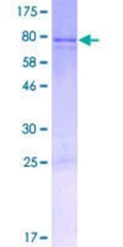 Novus Biologicals Recombinant Human KIAA0895 GST (N-Term) Protein 2 &mu;g | Buy Online | Novus Biologicals&trade; | Fisher Scientific