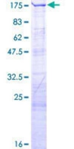 Novus Biologicals Recombinant Human LARP1 GST (N-Term) Protein 2 &mu;g | Buy Online | Novus Biologicals&trade; | Fisher Scientific