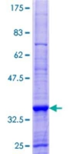 Novus Biologicals Recombinant Human p114RhoGEF GST (N-Term) Protein 10 &mu;g | Buy Online | Novus Biologicals&trade; | Fisher Scientific