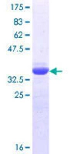Novus Biologicals Recombinant Human TORC1 GST (N-Term) Protein 10 &mu;g | Buy Online | Novus Biologicals&trade; | Fisher Scientific