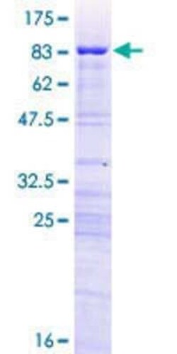 Novus Biologicals Recombinant Human HUCE1 GST (N-Term) Protein 10 &mu;g | Buy Online | Novus Biologicals&trade; | Fisher Scientific