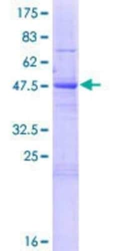 Novus Biologicals Recombinant Human MAU2 GST (N-Term) Protein 10 &mu;g | Buy Online | Novus Biologicals&trade; | Fisher Scientific