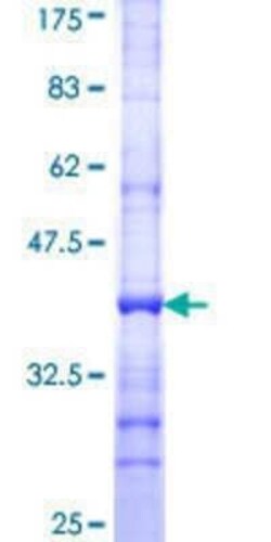 Novus Biologicals Recombinant Human THRAP2 GST (N-Term) Protein 25 &mu;g | Buy Online | Novus Biologicals&trade; | Fisher Scientific