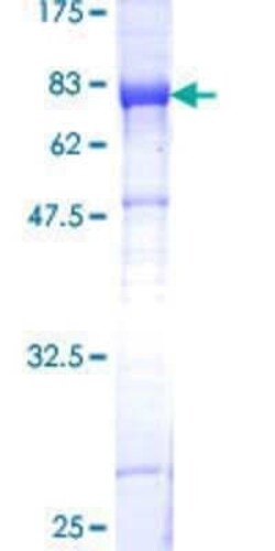 Novus Biologicals Recombinant Human ECM29 GST (N-Term) Protein 25 &mu;g | Buy Online | Novus Biologicals&trade; | Fisher Scientific