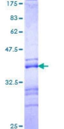 Novus Biologicals Recombinant Human ADNP GST (N-Term) Protein 25 &mu;g | Buy Online | Novus Biologicals&trade; | Fisher Scientific