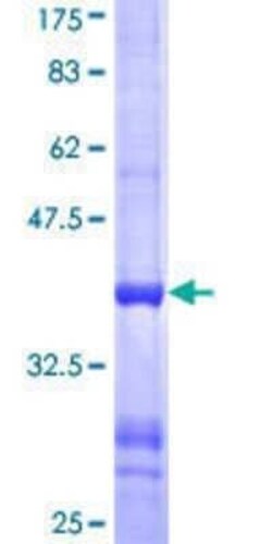 Novus Biologicals Recombinant Human LARS2 GST (N-Term) Protein 25 &mu;g | Buy Online | Novus Biologicals&trade; | Fisher Scientific