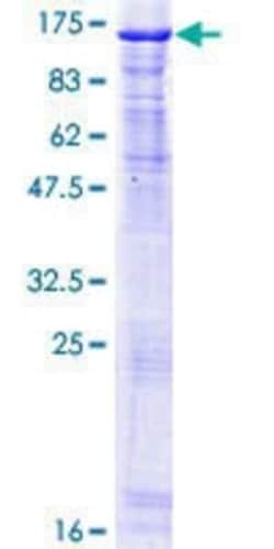 Novus Biologicals Recombinant Human NCAPH GST (N-Term) Protein 25 &mu;g | Buy Online | Novus Biologicals&trade; | Fisher Scientific