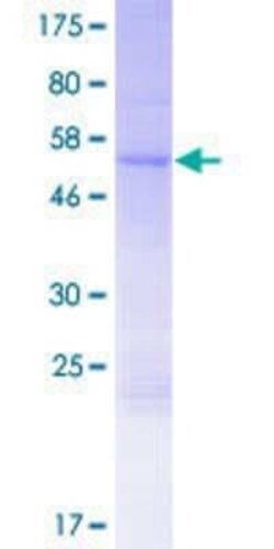 Novus Biologicals Recombinant Human FRAT2 GST (N-Term) Protein 2 &mu;g | Buy Online | Novus Biologicals&trade; | Fisher Scientific