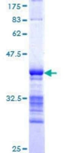 Novus Biologicals Recombinant Human FBXO46 GST (N-Term) Protein 25 &mu;g | Buy Online | Novus Biologicals&trade; | Fisher Scientific
