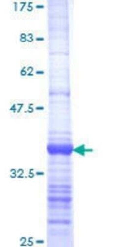 Novus Biologicals Recombinant Human RRP4 GST (N-Term) Protein 25 &mu;g | Buy Online | Novus Biologicals&trade; | Fisher Scientific