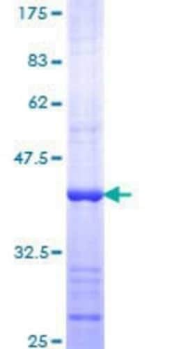 Novus Biologicals Recombinant Human Dicer GST (N-Term) Protein 10 &mu;g | Buy Online | Novus Biologicals&trade; | Fisher Scientific