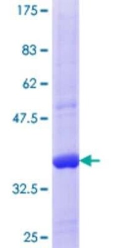 Novus Biologicals Recombinant Human SIRT4 GST (N-Term) Protein 10 &mu;g | Buy Online | Novus Biologicals&trade; | Fisher Scientific