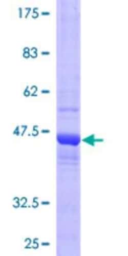 Novus Biologicals Recombinant Human COMMD3 GST (N-Term) Protein 25 &mu;g | Buy Online | Novus Biologicals&trade; | Fisher Scientific