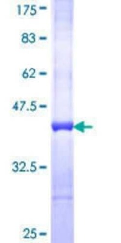 Novus Biologicals Recombinant Human COMMD3 GST (N-Term) Protein 10 &mu;g | Buy Online | Novus Biologicals&trade; | Fisher Scientific