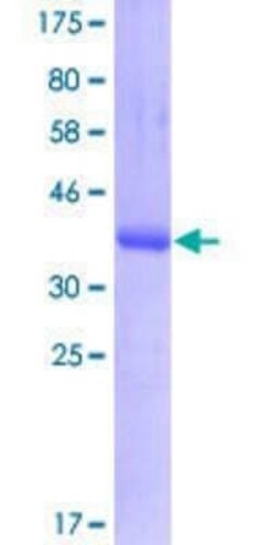 Novus Biologicals Recombinant Human CRB1 GST (N-Term) Protein 10 &mu;g | Buy Online | Novus Biologicals&trade; | Fisher Scientific