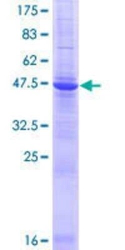 Novus Biologicals Recombinant Human TMED3 GST (N-Term) Protein 10 &mu;g | Buy Online | Novus Biologicals&trade; | Fisher Scientific