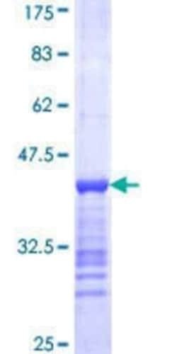 Novus Biologicals Recombinant Human GRIP1 GST (N-Term) Protein 25 &mu;g | Buy Online | Novus Biologicals&trade; | Fisher Scientific