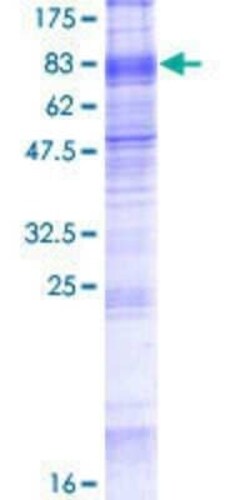 Novus Biologicals Recombinant Human SLC7A8 GST (N-Term) Protein 2 &mu;g | Buy Online | Novus Biologicals&trade; | Fisher Scientific
