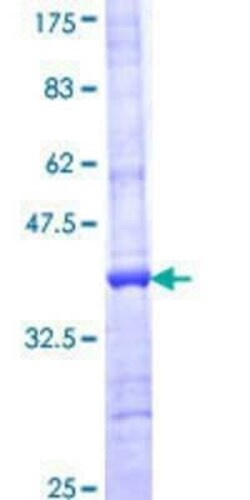 Novus Biologicals Recombinant Human AP4E1 GST (N-Term) Protein 25 &mu;g | Buy Online | Novus Biologicals&trade; | Fisher Scientific