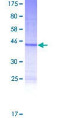 Novus Biologicals Recombinant Human GR6 GST (N-Term) Protein 10 &mu;g | Buy Online | Novus Biologicals&trade; | Fisher Scientific