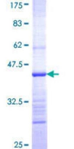 Novus Biologicals Recombinant Human HARS2 GST (N-Term) Protein 25 &mu;g | Buy Online | Novus Biologicals&trade; | Fisher Scientific