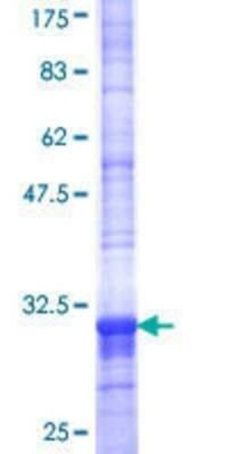 Novus Biologicals Recombinant Human SLC35A3 GST (N-Term) Protein 10 &mu;g | Buy Online | Novus Biologicals&trade; | Fisher Scientific