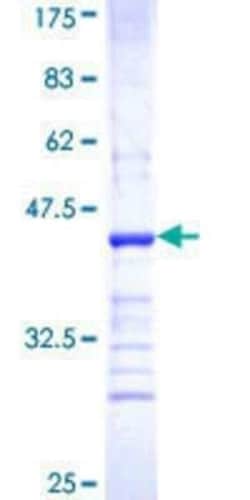 Novus Biologicals Recombinant Human ABCB9 GST (N-Term) Protein 25 &mu;g | Buy Online | Novus Biologicals&trade; | Fisher Scientific
