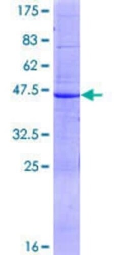 Novus Biologicals Recombinant Human ABCA6 GST (N-Term) Protein 2 &mu;g | Buy Online | Novus Biologicals&trade; | Fisher Scientific
