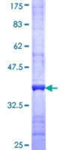 Novus Biologicals Recombinant Human ABCA6 GST (N-Term) Protein 10 &mu;g | Buy Online | Novus Biologicals&trade; | Fisher Scientific