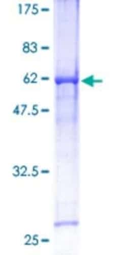 Novus Biologicals Recombinant Human HEY1 GST (N-Term) Protein 10 &mu;g | Buy Online | Novus Biologicals&trade; | Fisher Scientific