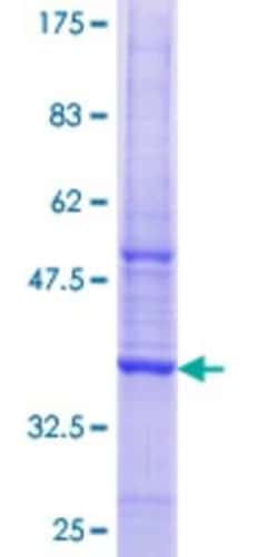 Novus Biologicals Recombinant Human Calpain 7 GST (N-Term) Protein 10 &mu;g | Buy Online | Novus Biologicals&trade; | Fisher Scientific