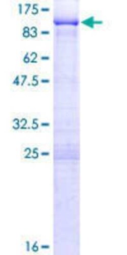 Novus Biologicals Recombinant Human Pescadillo GST (N-Term) Protein 25 &mu;g | Buy Online | Novus Biologicals&trade; | Fisher Scientific