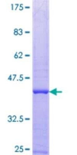 Novus Biologicals Recombinant Human Pescadillo GST (N-Term) Protein 10 &mu;g | Buy Online | Novus Biologicals&trade; | Fisher Scientific