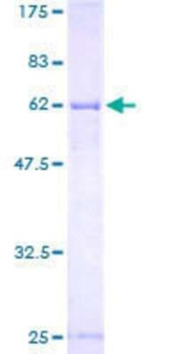 Novus Biologicals Recombinant Human TGDS GST (N-Term) Protein 10 &mu;g | Buy Online | Novus Biologicals&trade; | Fisher Scientific