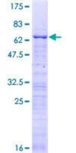 Novus Biologicals Recombinant Human CBX7 GST (N-Term) Protein 10 &mu;g | Buy Online | Novus Biologicals&trade; | Fisher Scientific