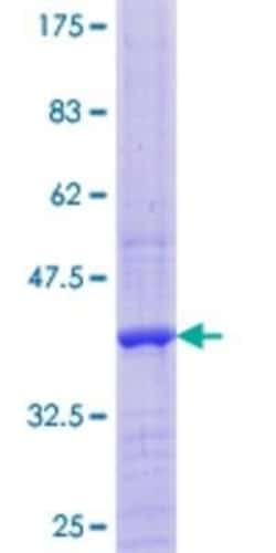 Novus Biologicals Recombinant Human DAAM2 GST (N-Term) Protein 10 &mu;g | Buy Online | Novus Biologicals&trade; | Fisher Scientific