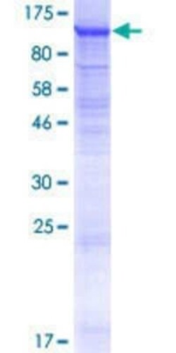 Novus Biologicals Recombinant Human LRRC8B GST (N-Term) Protein 10 &mu;g | Buy Online | Novus Biologicals&trade; | Fisher Scientific