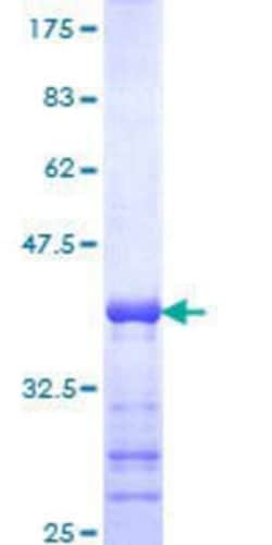 Novus Biologicals Recombinant Human CAIN GST (N-Term) Protein 25 &mu;g | Buy Online | Novus Biologicals&trade; | Fisher Scientific