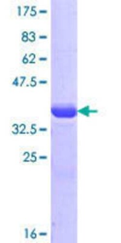 Novus Biologicals Recombinant Human HA-1 GST (N-Term) Protein 25 &mu;g | Buy Online | Novus Biologicals&trade; | Fisher Scientific