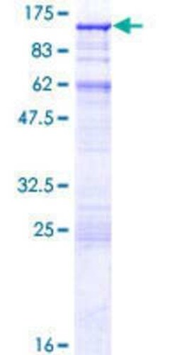 Novus Biologicals Recombinant Human Centaurin beta 2 GST (N-Term) Protein 10 &mu;g | Buy Online | Novus Biologicals&trade; | Fisher Scientific