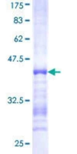 Novus Biologicals Recombinant Human Centaurin beta 2 GST (N-Term) Protein 25 &mu;g | Buy Online | Novus Biologicals&trade; | Fisher Scientific
