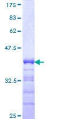 Novus Biologicals Recombinant Human ZNF281 GST (N-Term) Protein 25 &mu;g | Buy Online | Novus Biologicals&trade; | Fisher Scientific