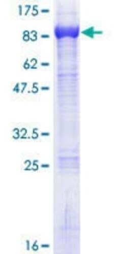 Novus Biologicals Recombinant Human TNPO3 GST (N-Term) Protein 25 &mu;g | Buy Online | Novus Biologicals&trade; | Fisher Scientific
