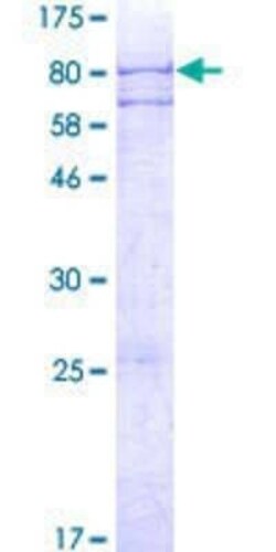 Novus Biologicals Recombinant Human ADAT1 GST (N-Term) Protein 2 &mu;g | Buy Online | Novus Biologicals&trade; | Fisher Scientific