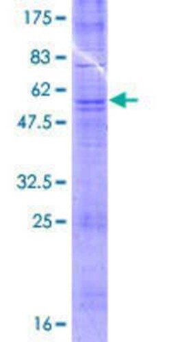 Novus Biologicals Recombinant Human OR52A1 GST (N-Term) Protein 25 &mu;g | Buy Online | Novus Biologicals&trade; | Fisher Scientific