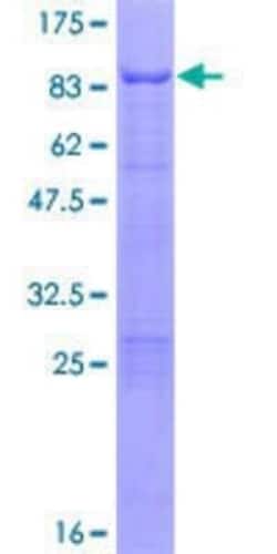 Novus Biologicals Recombinant Human JIP2 GST (N-Term) Protein 25 &mu;g | Buy Online | Novus Biologicals&trade; | Fisher Scientific
