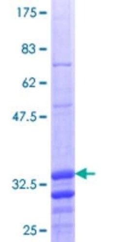 Novus Biologicals Recombinant Human CDK20 GST (N-Term) Protein 10 &mu;g | Buy Online | Novus Biologicals&trade; | Fisher Scientific